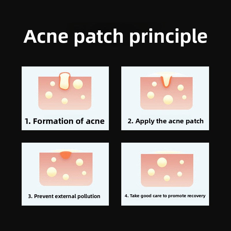 Cartoon Acne Patches (28-51 patches)